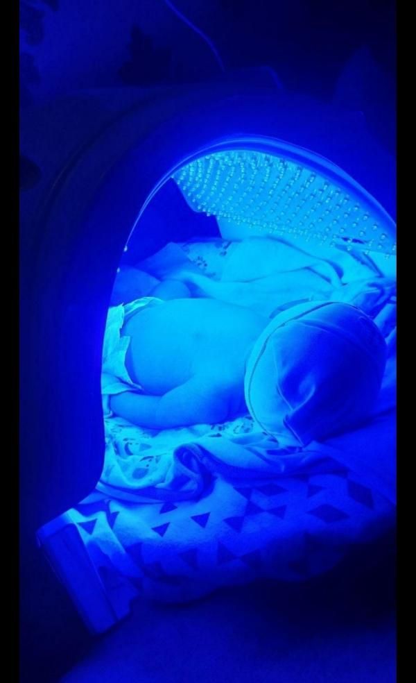 دستگاه زردی فتوتراپی|پزشکی|قزوین, |دیوار