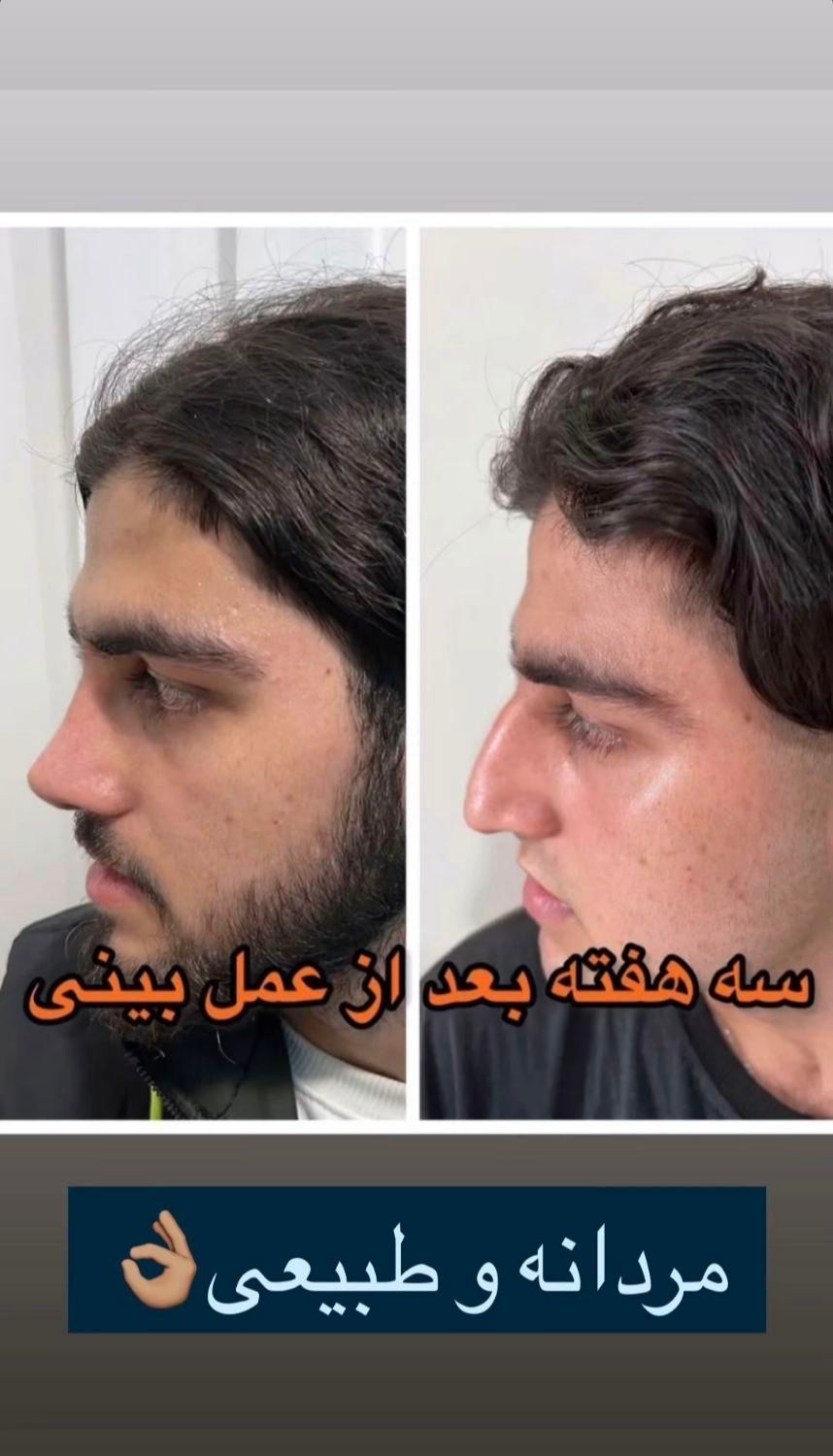 دکتر اسدالله‌پور، جراح برتر بینی در مازندران|خدمات آرایشگری و زیبایی|قائم‌شهر, |دیوار