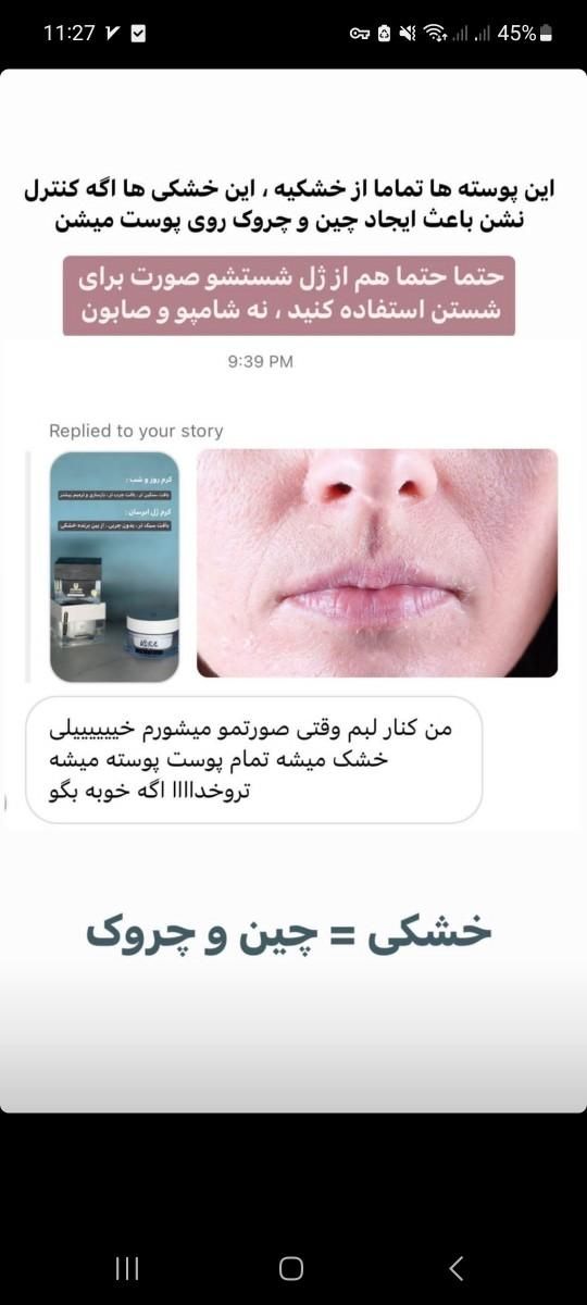 ژل آبرسان ویتابلا|آرایشی، بهداشتی، درمانی|تهران, باغ فردوس|دیوار