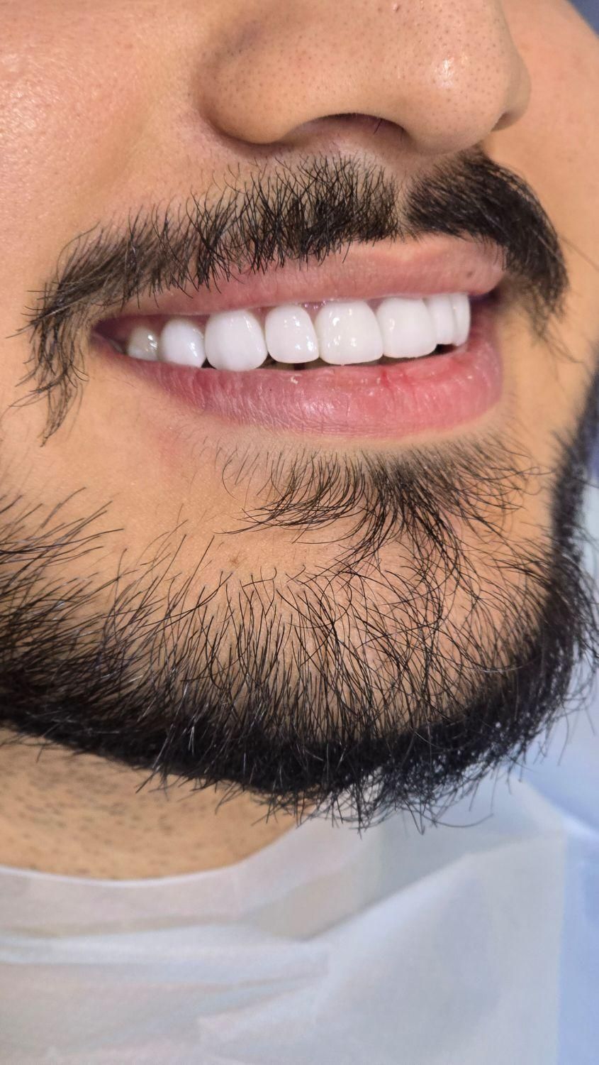 جشنواره اقساطی دندانپزشکی بدون پیش پرداخت|خدمات آرایشگری و زیبایی|شیراز, بعثت|دیوار