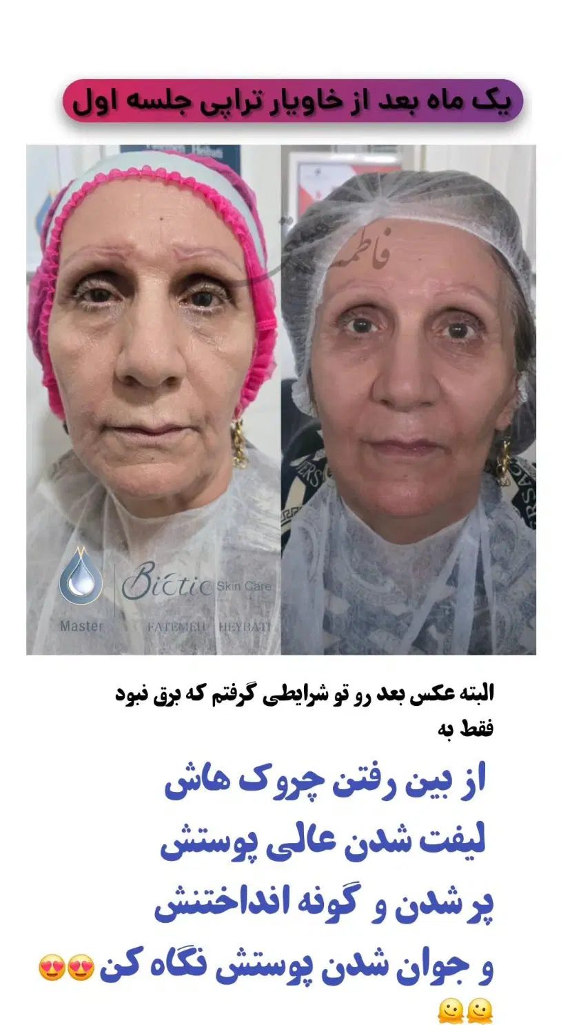 ترمیم و بازسازی انواع ناهنجاری های پوستی|خدمات آرایشگری و زیبایی|شیراز, قصرالدشت|دیوار