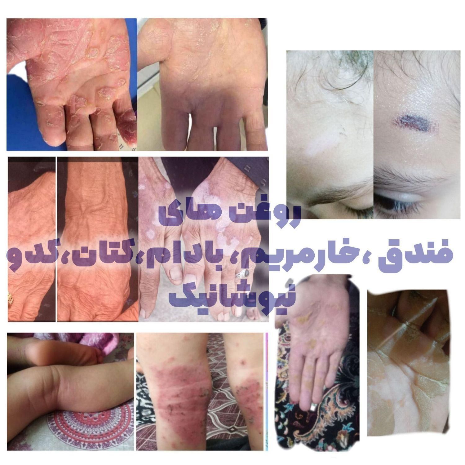 کبدچرب و یبوستت رو با روغن خوراکی درمان کن|آرایشی، بهداشتی، درمانی|شیراز, بریجستون|دیوار