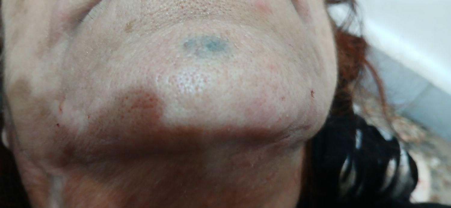 الکترولیز موی سفید وسیاه صورت بانوان فقط|خدمات آرایشگری و زیبایی|بروجرد, |دیوار