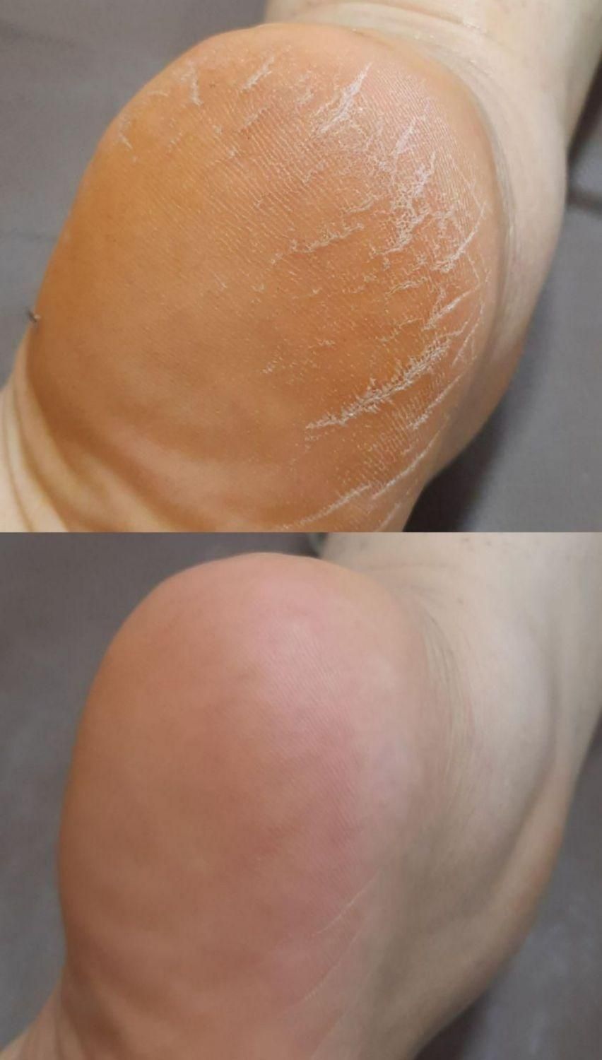 پدیکور درمانی|خدمات آرایشگری و زیبایی|اسدآباد, |دیوار