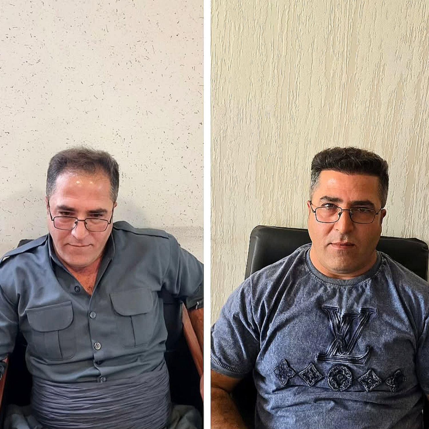 کاشت مو تضمینی و اقساطی در محیطی کاملا vip|خدمات آرایشگری و زیبایی|یزد, |دیوار