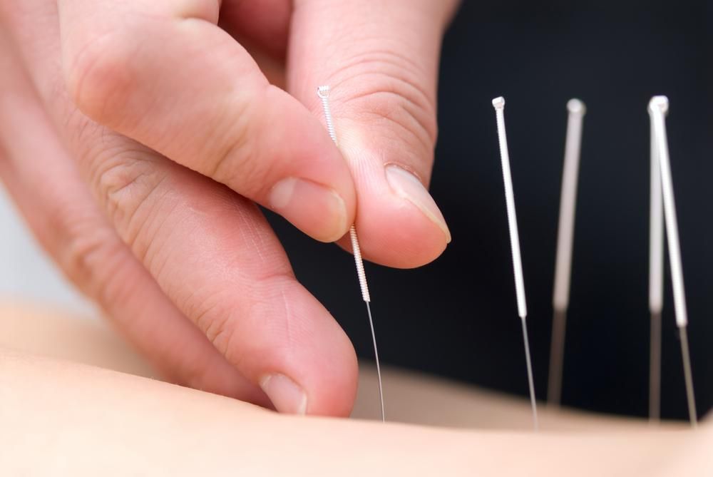 دوره تخصصی طب سوزنی با ارائه مدرک بین‌المللی|خدمات آموزشی|تهران, پیروزی|دیوار