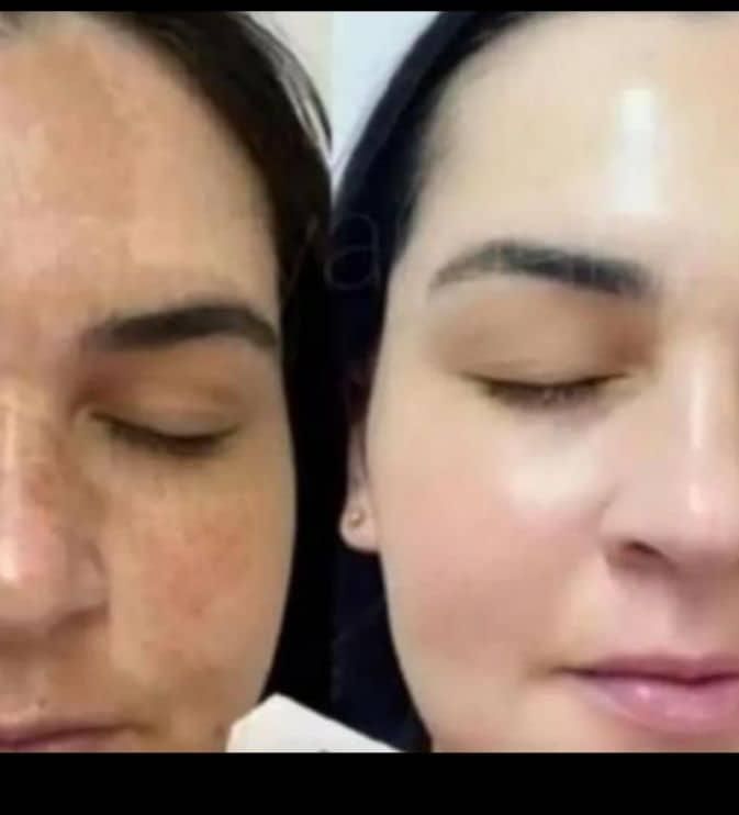 کرم چهل گیاه معجزه|آرایشی، بهداشتی، درمانی|شیراز, انجیر|دیوار