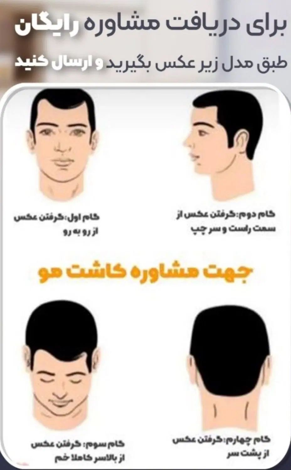 بیا اقساطی مو بکار کاشت مو و ابرو و ریش تضمینی|خدمات آرایشگری و زیبایی|ارومیه, |دیوار