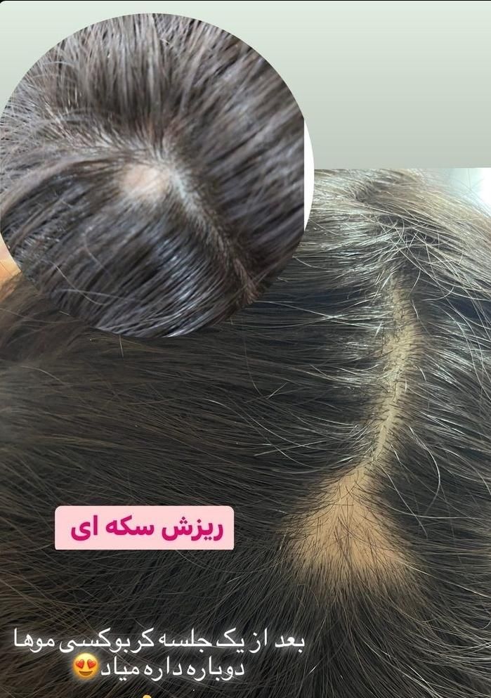 پاکسازی کف سر اسکراب اسکالپ|خدمات آرایشگری و زیبایی|مشهد, الهیه|دیوار