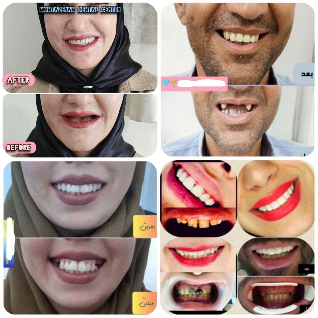 معاینات رایگان و خدمات دندانپزشکی خیابان امام رضاع|خدمات آرایشگری و زیبایی|مشهد, امام رضا (ع)|دیوار