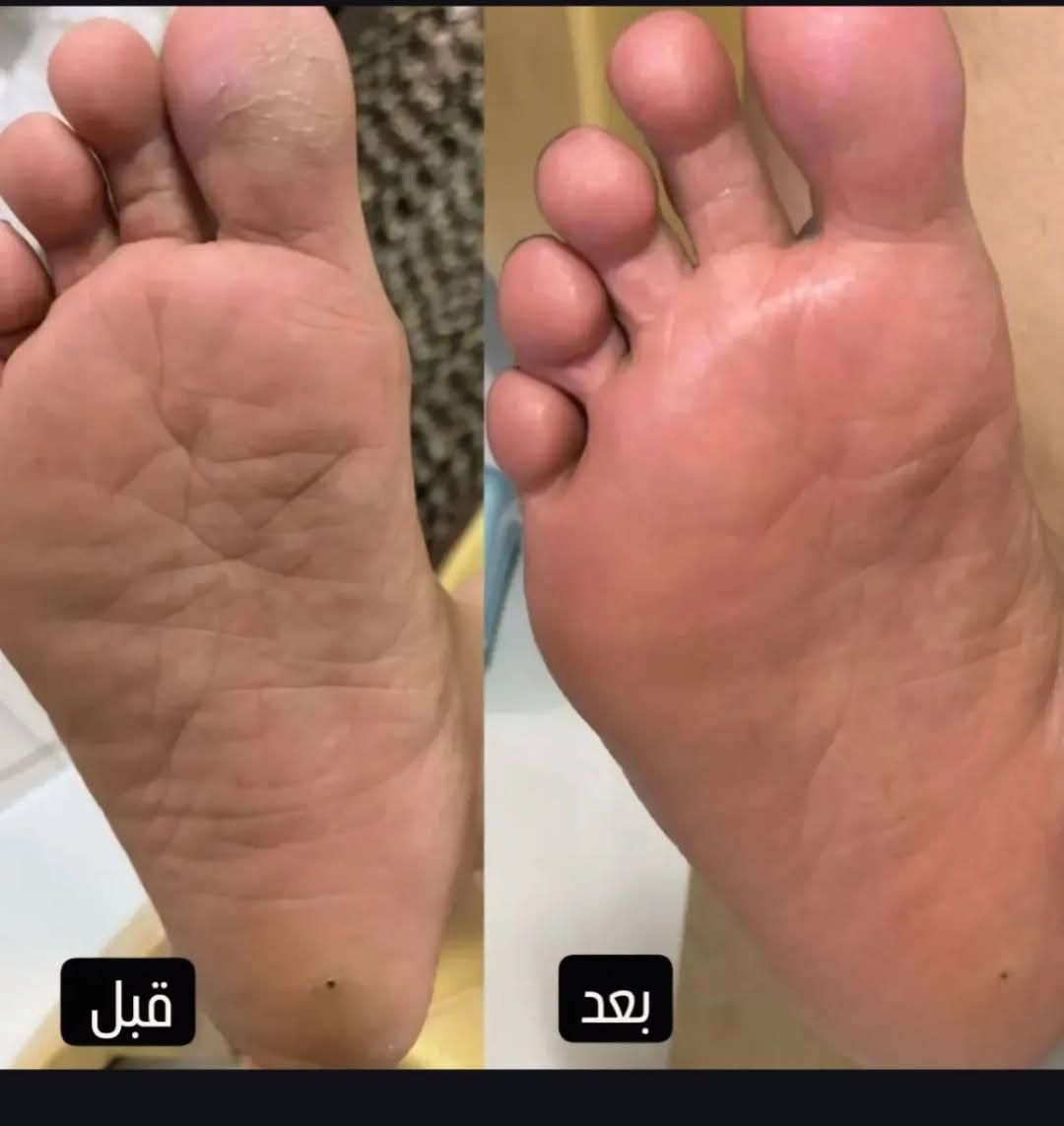 پدیکورتخصصی.وکف سابی و پارافین تراپی|خدمات آرایشگری و زیبایی|ارومیه, |دیوار