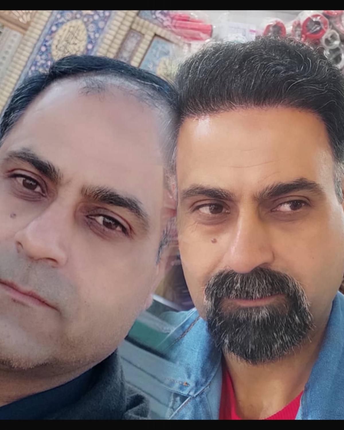 کاشت مو تضمینی در یک جلسه با تکنیک شیرازی|خدمات آرایشگری و زیبایی|یزد, |دیوار