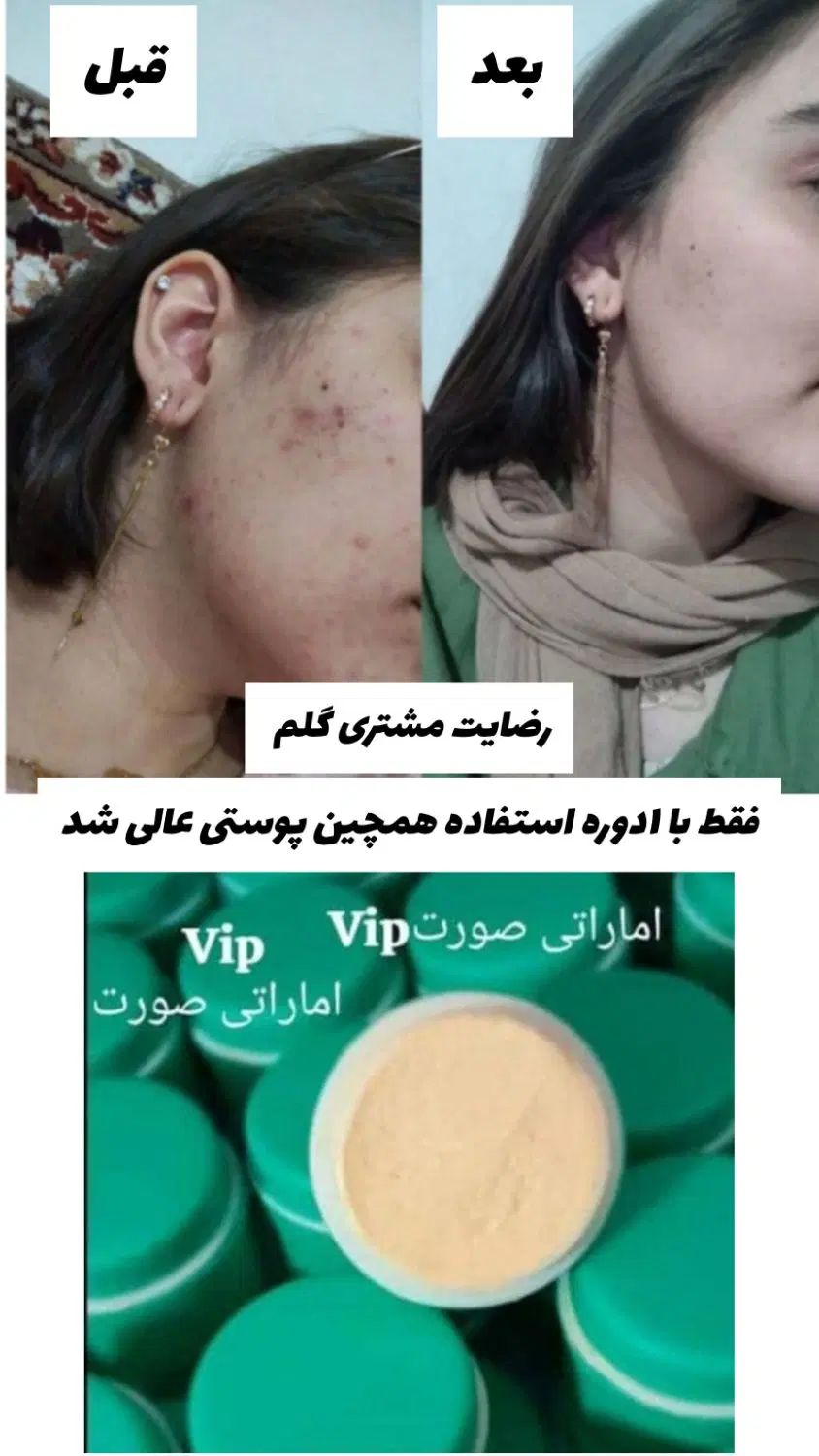 کرم معجزه گر وی ای پی بشدت قوی صورت دست پا|آرایشی، بهداشتی، درمانی|اهواز, کوی باهنر|دیوار