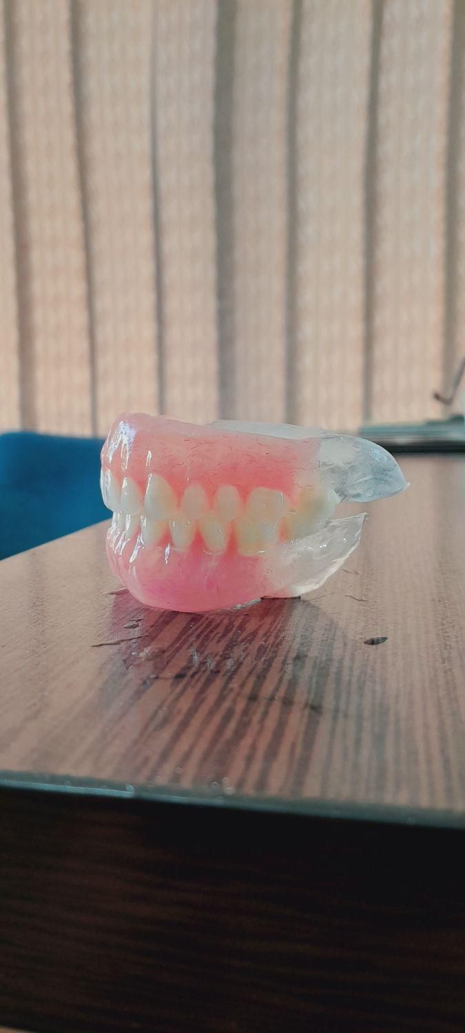 دندانسازی ، دندان مصنوعی|پزشکی|اصفهان, شاهد|دیوار