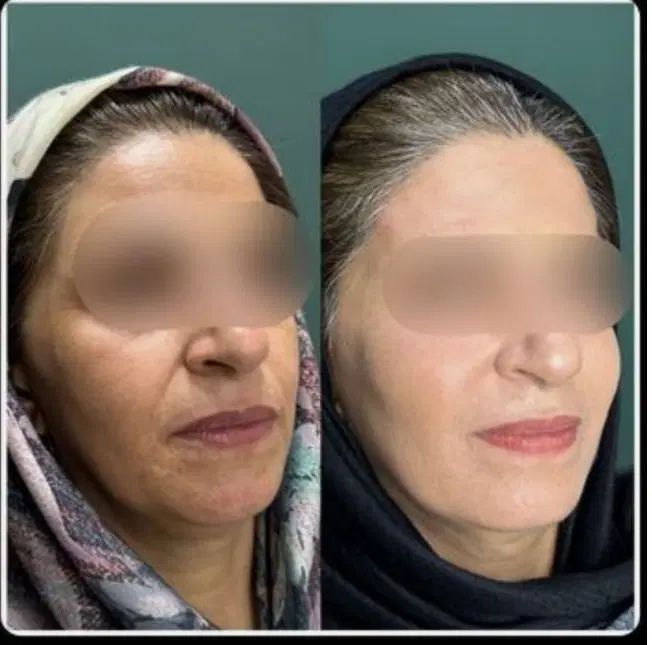 یک مرکز جامع خدمات و آموزش تمام لاین های زیبایی|خدمات آرایشگری و زیبایی|اهواز, پادادشهر|دیوار