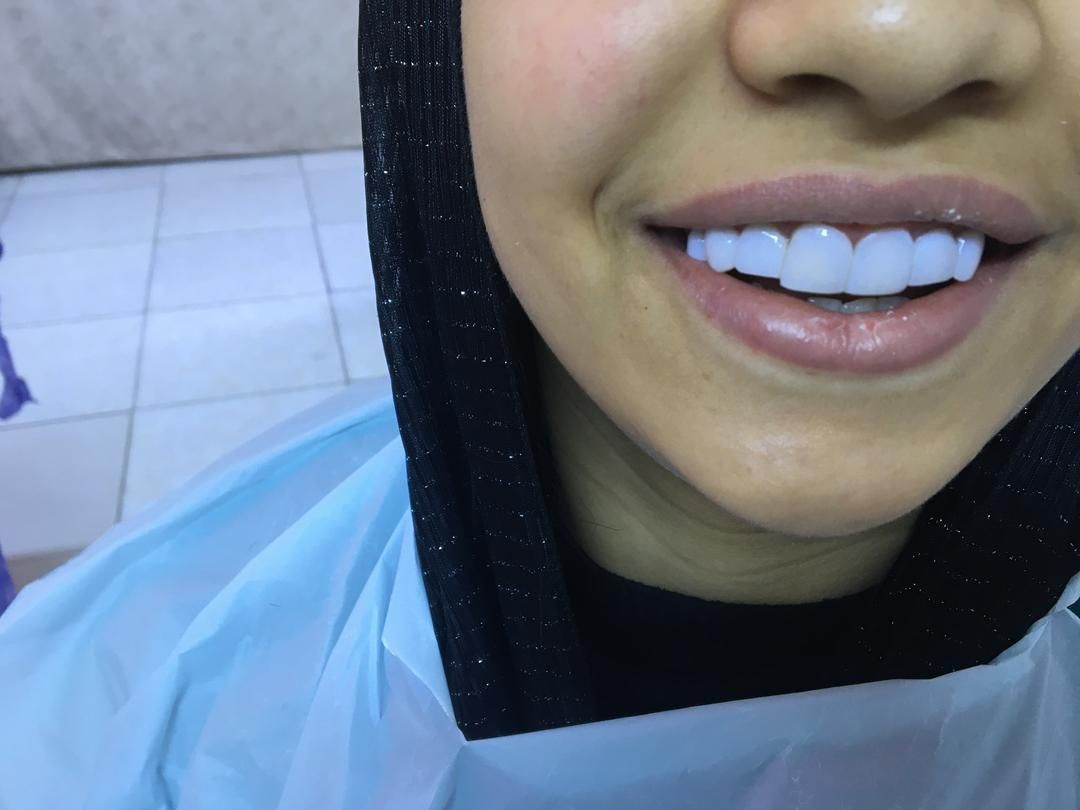 دندانپزشکی انجام تمامی خدمات دندانپزشکی|خدمات آرایشگری و زیبایی|تبریز, |دیوار