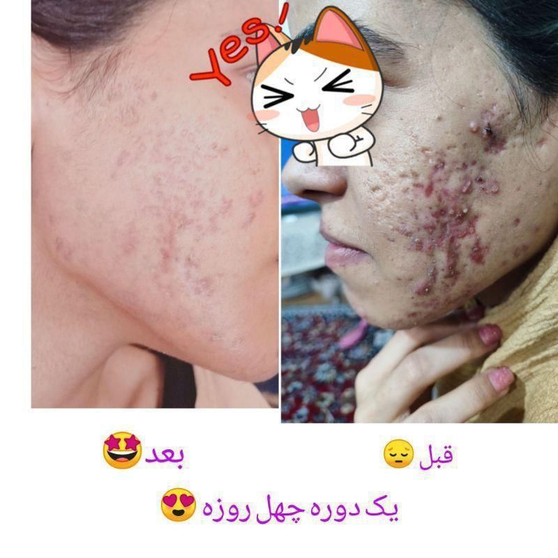 اموزش ساخت انواع لوازم آرایشی|خدمات آموزشی|تهران, نصرت|دیوار
