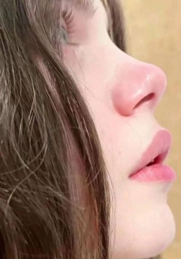 عمل زیبایی صورت و بدن / بینی با روش های جدید|خدمات آرایشگری و زیبایی|شیراز, بعثت|دیوار