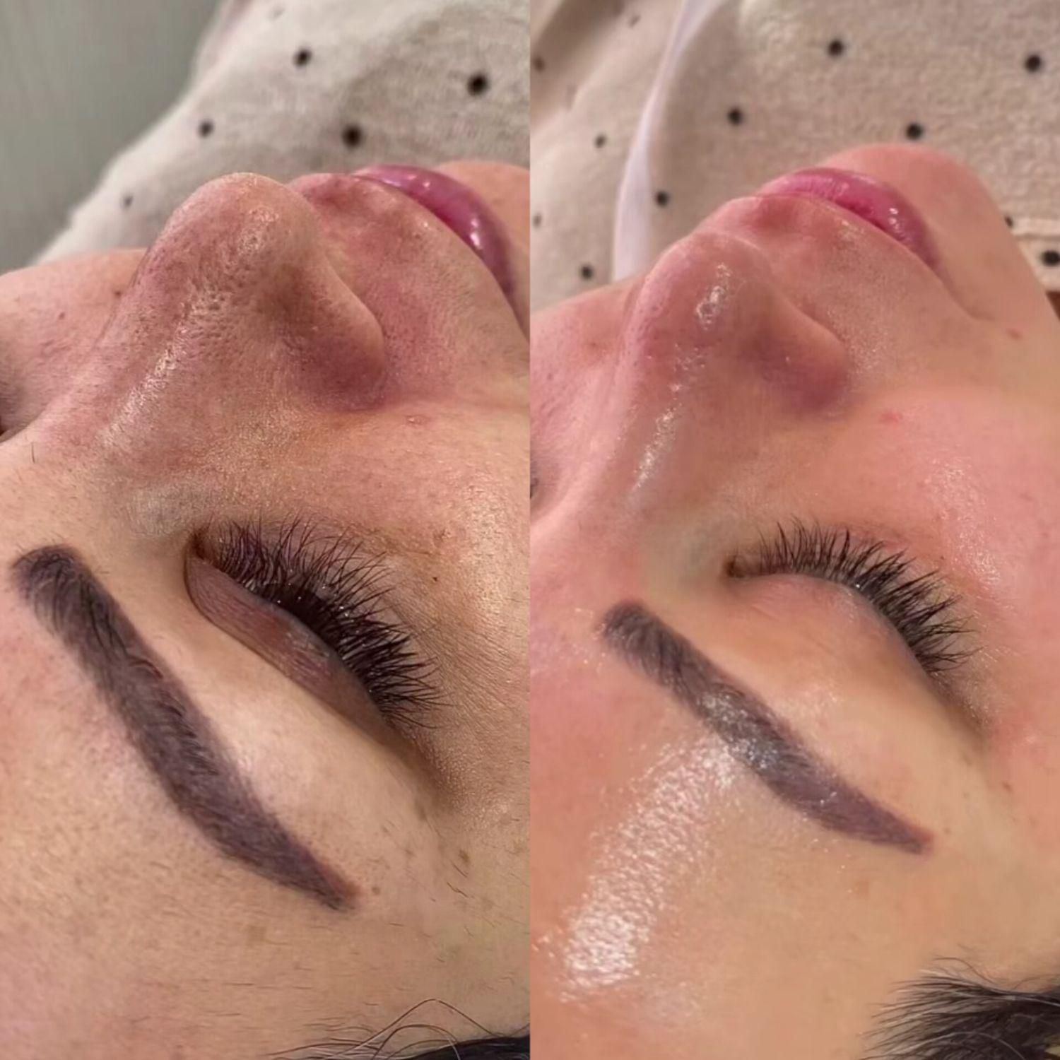 پاکسازی پوست به همراه دستگاه شروع قیمت از 280|خدمات آرایشگری و زیبایی|شیراز, کاراندیش|دیوار