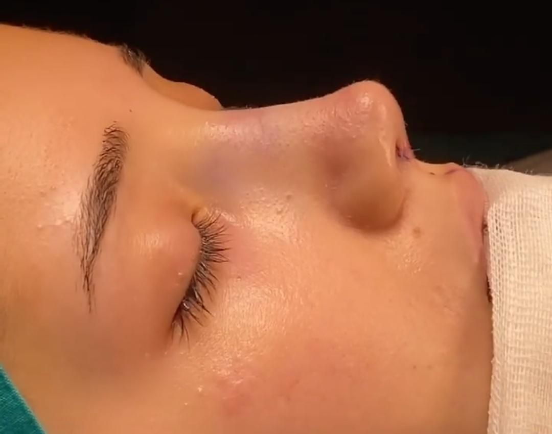 خدمات عمل جراحی زیبایی بینی و ترمیم بینی|خدمات آرایشگری و زیبایی|تهران, فلاح|دیوار