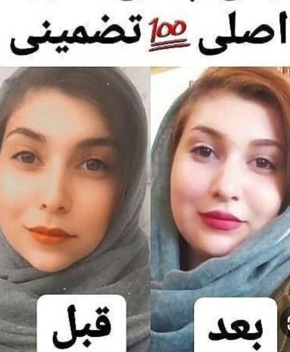 حجم دهنده صورت طبیعی و تضمینی|آرایشی، بهداشتی، درمانی|اصفهان, ابر|دیوار