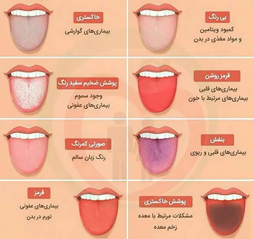 سونوگرافی و تشخیص بیماری های شما از روی زبان|خدمات آرایشگری و زیبایی|مشهد, رضاشهر|دیوار