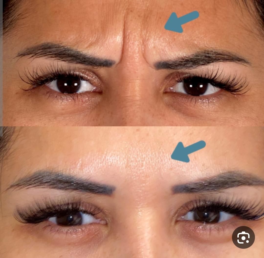 جشنواره ژل و بوتاکس و فیلر بادی(بدن)|خدمات آرایشگری و زیبایی|اصفهان, شهرک کاوه|دیوار