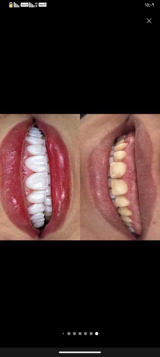 دندانپزشکی|خدمات آرایشگری و زیبایی|تهران, آرژانتین|دیوار