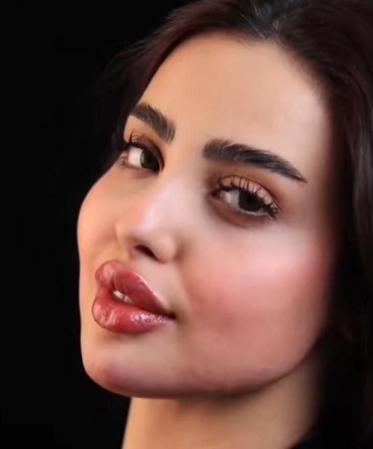 تزریق ژل لب روسی بوتاکس چشم گربه ای فیلرزیرچشم|خدمات آرایشگری و زیبایی|تهران, ستارخان|دیوار