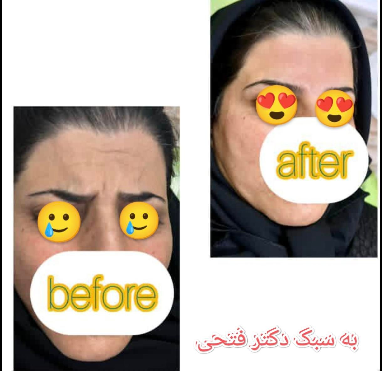 انجام کلیه خدمات زیبایی توسط پزشک در کلینیک در فسا|خدمات آرایشگری و زیبایی|فسا, |دیوار