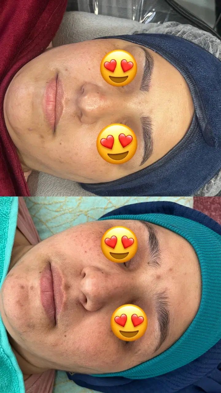 فیشیال و تجویز روتین پوستی اختصاصی رایگان|خدمات آرایشگری و زیبایی|یزد, |دیوار