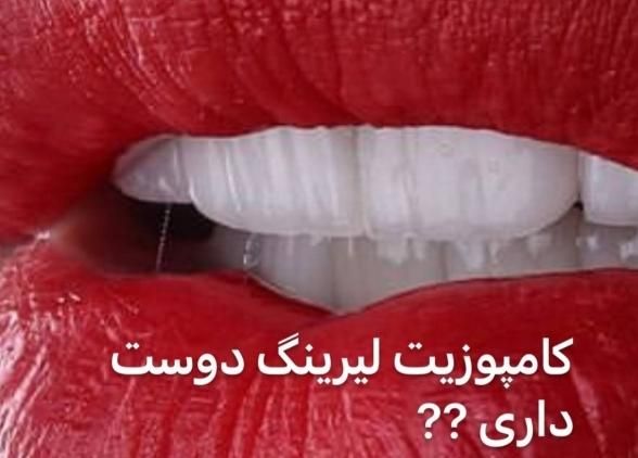 آموزش کامپوزیت دندان تخفیف ۵۰ درصدی|خدمات آموزشی|اندیشه, |دیوار