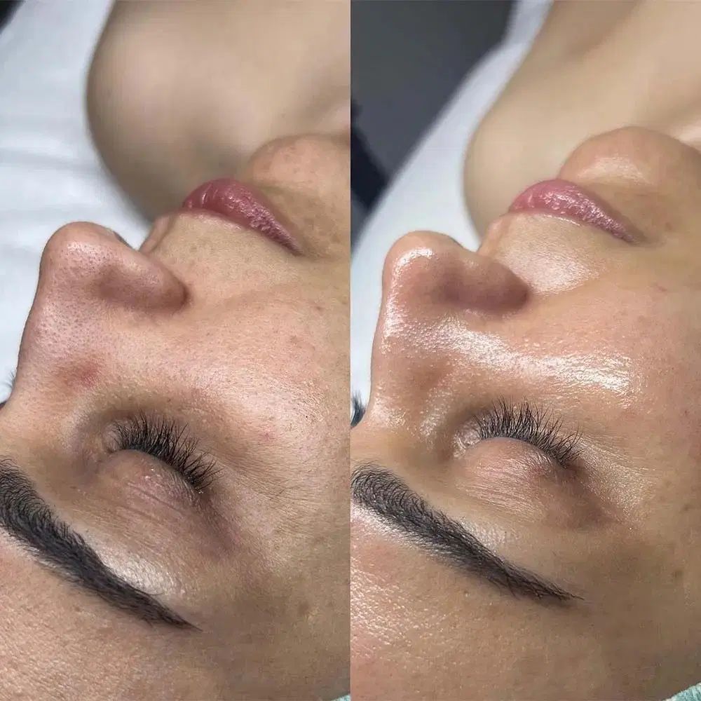 فیشیال و پاکسازی|خدمات آرایشگری و زیبایی|مشهد, اقبال|دیوار