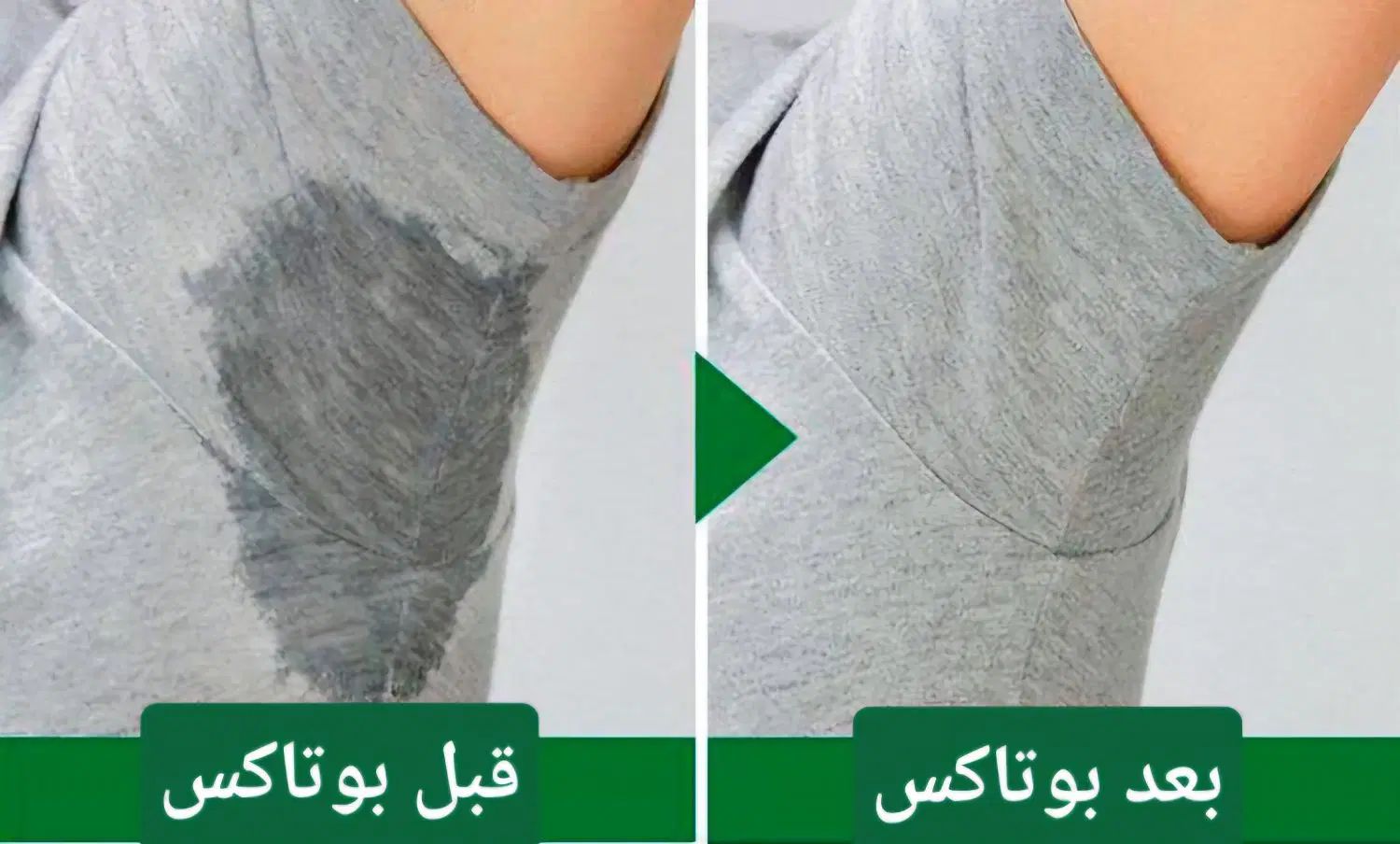 خدمات تخصصی بوتاکس و فیلر در منزل (پزشک مجرب)|خدمات آرایشگری و زیبایی|تهران, اباذر|دیوار