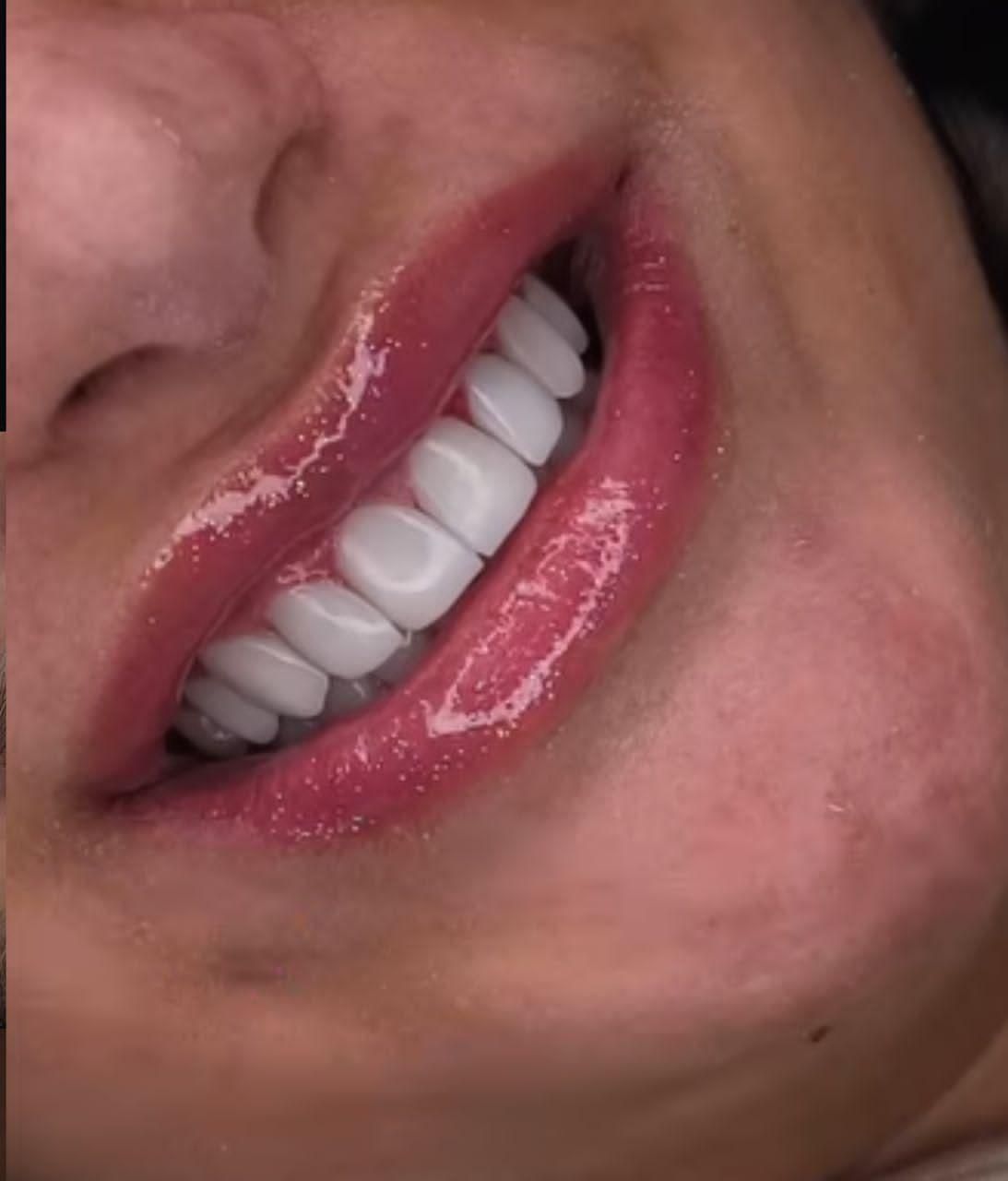 کامپوزیت ونیر|خدمات آرایشگری و زیبایی|شهریار, شهرک وائین|دیوار