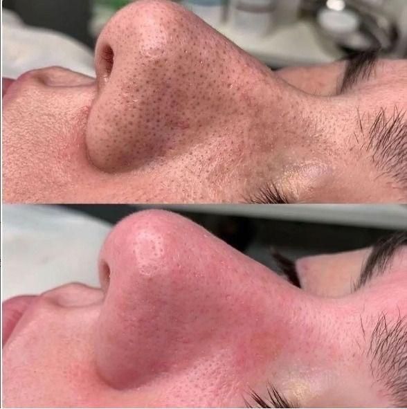 پاکسازی و جوانسازی پوست (فیشیال)|خدمات آرایشگری و زیبایی|تهران, مدائن|دیوار