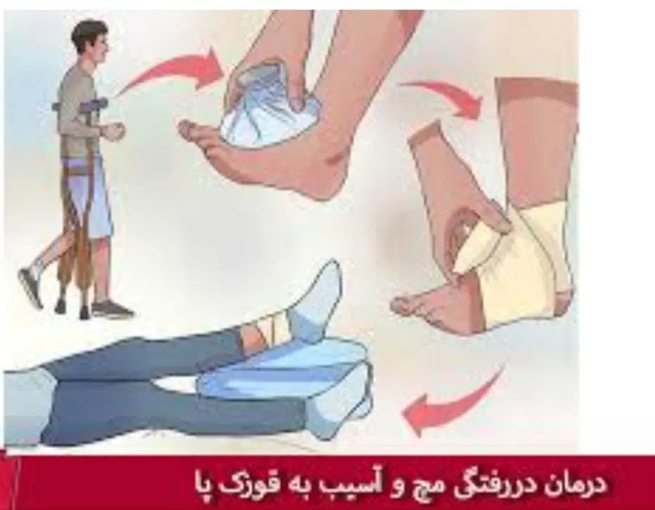 شکست بندی جا انداختن دست وپا رگگیری سیاه تیک|خدمات آرایشگری و زیبایی|مشهد, الهیه|دیوار