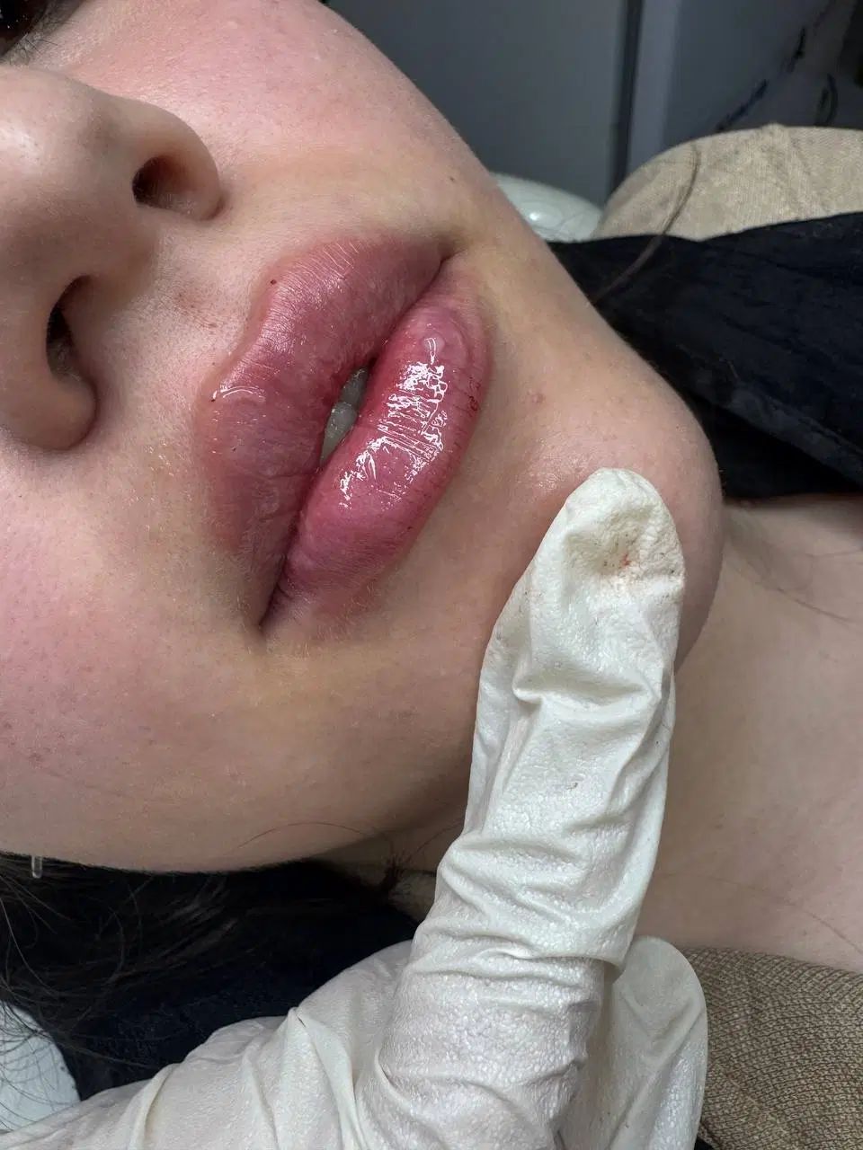 نیاز به مدل جهت تزریق رایگان ژل لب و فول فیس|خدمات آرایشگری و زیبایی|قم, سالاریه|دیوار