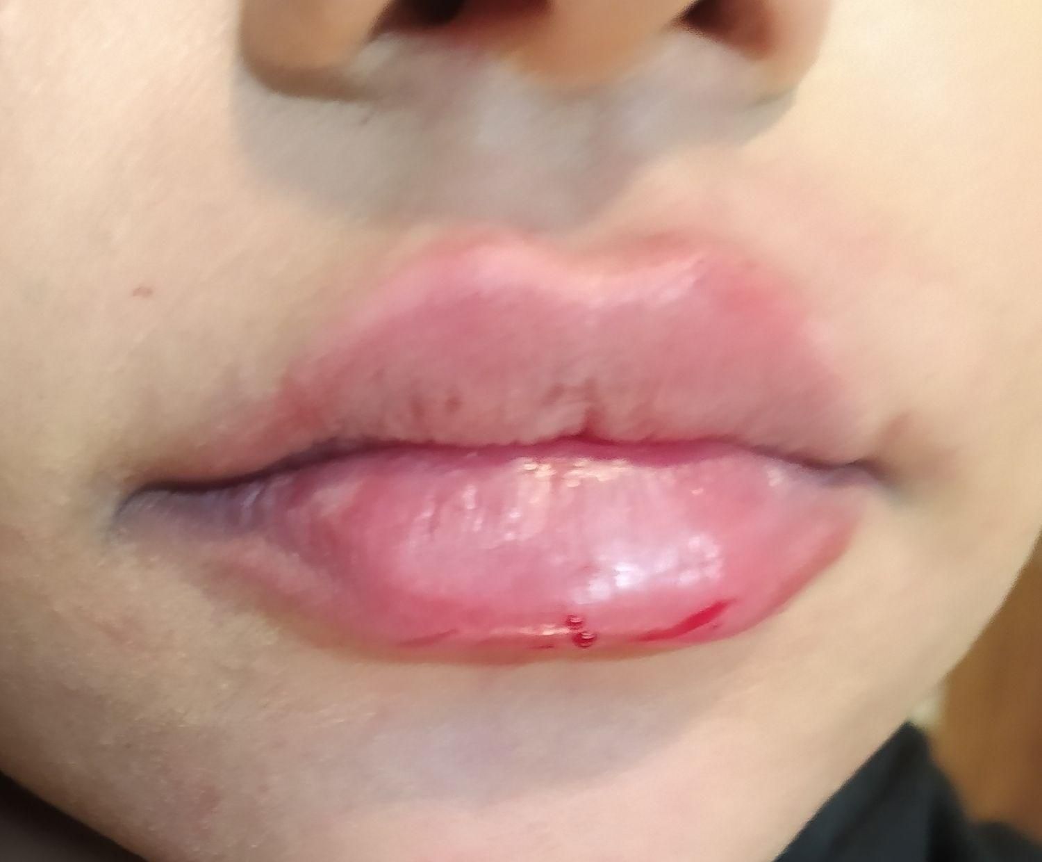 دکتر اکرم آقابیگی پوست مو زیبایی|خدمات آرایشگری و زیبایی|ملایر, |دیوار