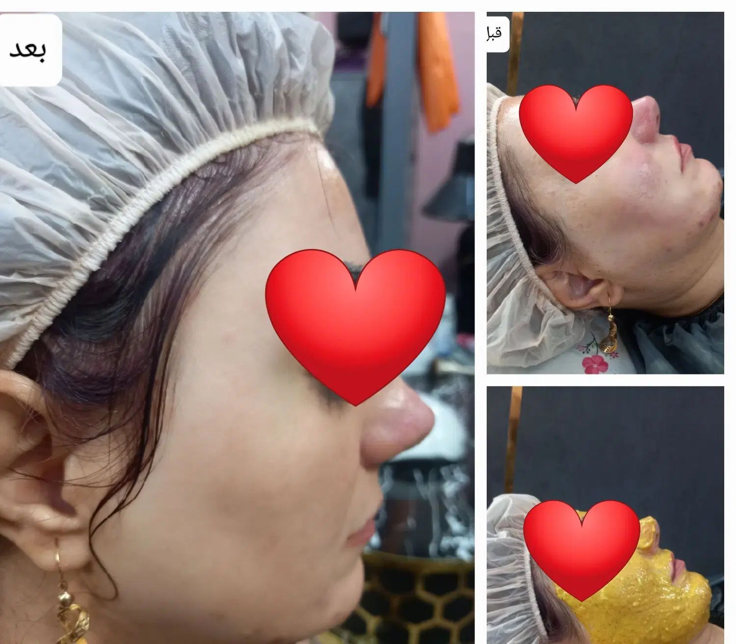 فشیال و خدمات جوانسازی ارغوان فقط دویست هزار تومان|خدمات آرایشگری و زیبایی|نیشابور, دارایی|دیوار