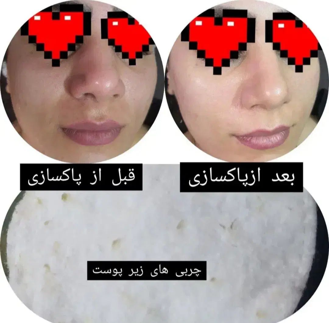 فیشیال تخصصی پوست به مدت محدود فقط۲۰۰تومن|خدمات آرایشگری و زیبایی|مشهد, طبرسی شمالی|دیوار