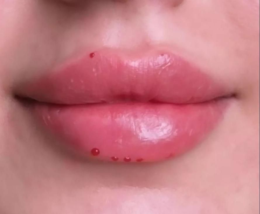 خدمات تخصصی فیلر و بوتاکس در رشت|خدمات آرایشگری و زیبایی|رشت, گلسار|دیوار