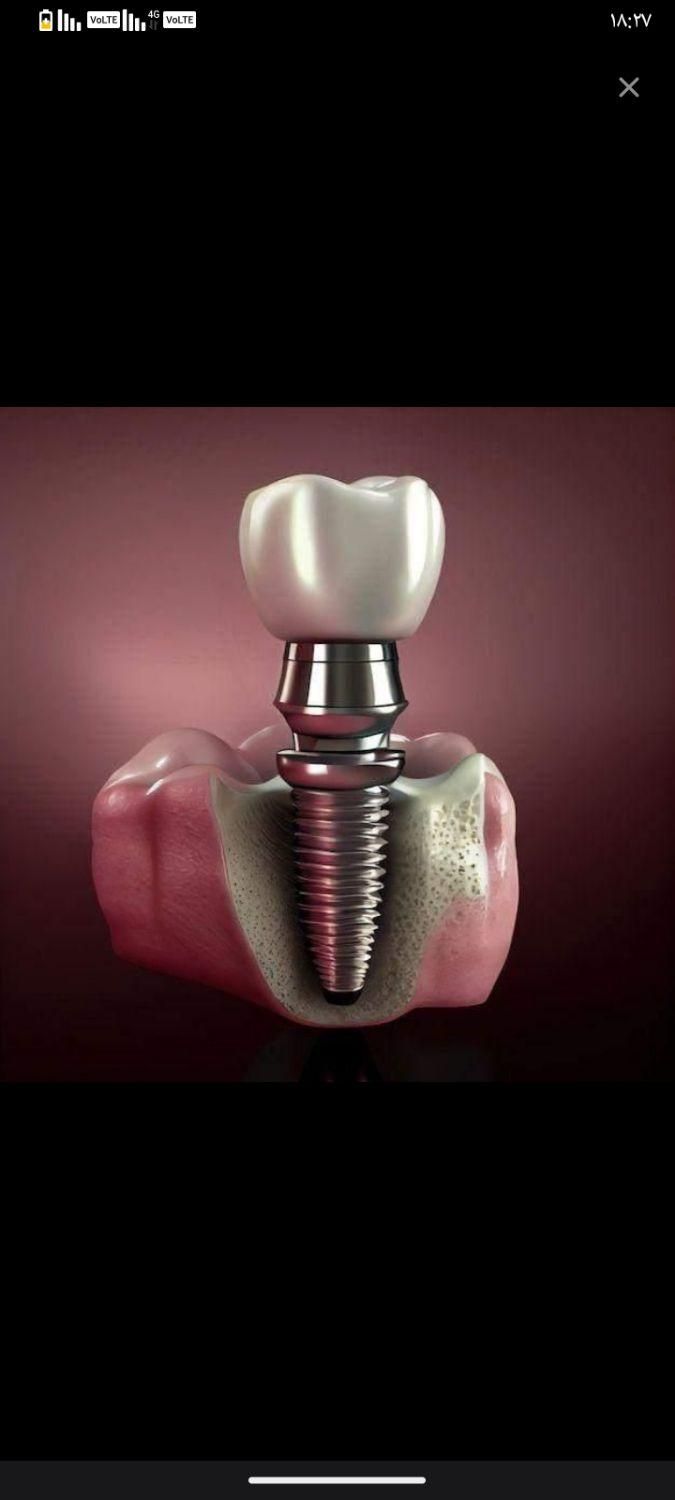 دندانپزشکی|خدمات آرایشگری و زیبایی|تهران, آرژانتین|دیوار