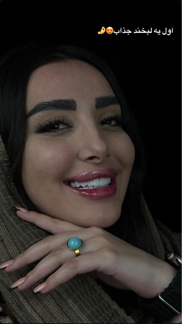کامپوزیت فکی۵میلیون عصبکشی۹۰۰تمام‌خدمات دندان قسط|خدمات آرایشگری و زیبایی|کرج, گوهردشت|دیوار