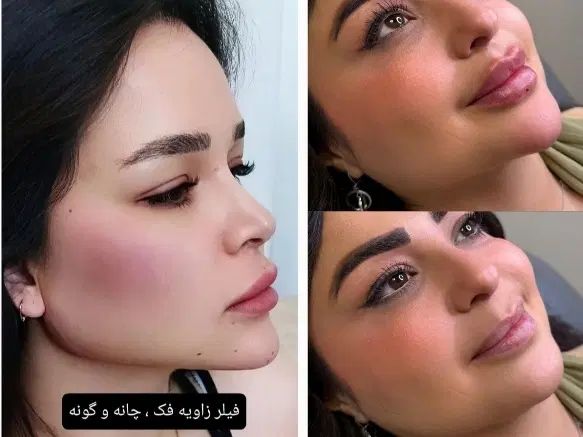 بیماریاب بازاریاب خانم و آقا کلینیک زیبایی|استخدام بازاریابی و فروش|یاسوج, |دیوار