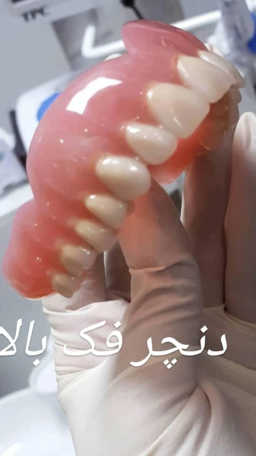 خدمات دندانپزشکی ترمیمی زیبایی ایمپلنت پروتز-اقساط|خدمات آرایشگری و زیبایی|ارومیه, |دیوار