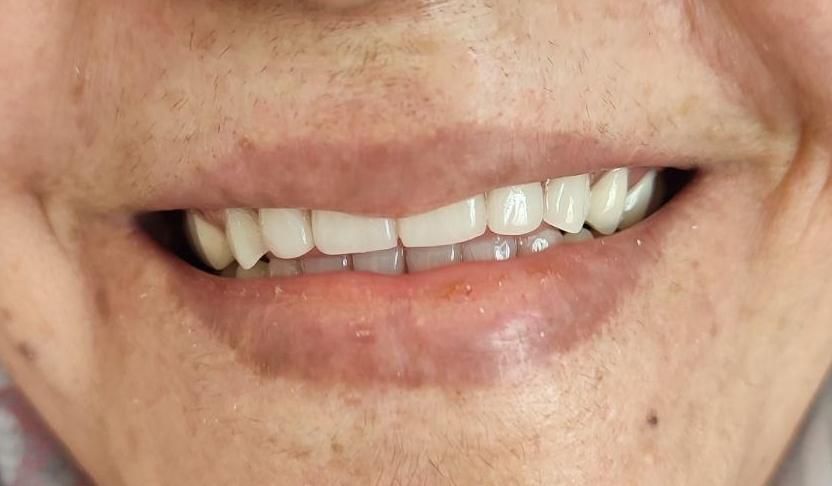 دندانسازی بانو دنت.با چک|خدمات آرایشگری و زیبایی|تربت‌حیدریه, داروپخش|دیوار