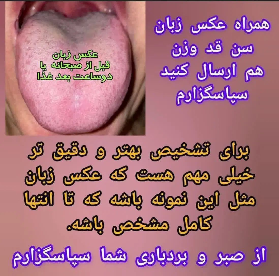 تشخیص بیماری‌ها از روی عکس زبان کاملا رایگان|خدمات آرایشگری و زیبایی|مشهد, فارغ التحصیلان|دیوار