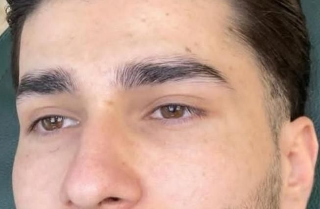 رفع تیرگی لب ،شیدینگ لب ،اسکالپ موی سر آقایون|خدمات آرایشگری و زیبایی|زاهدان, |دیوار