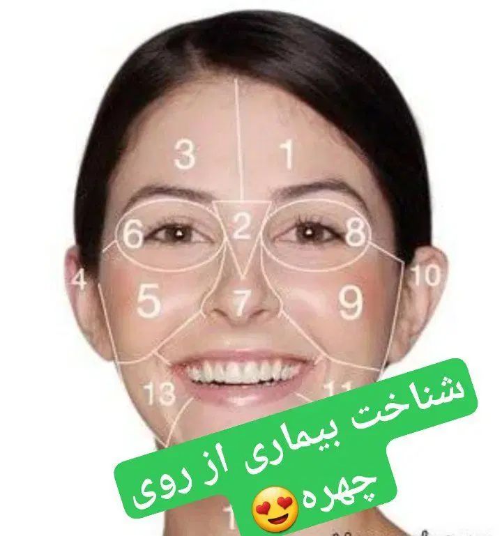 آموزش آنلاین و رایگان شناخت بیماریها از روی چهره|خدمات آموزشی|سیرجان, |دیوار